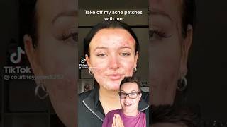 😨THE TRUTH ABOUT PIMPLE PATCHES What TikTok Doesnt Tell You shorts [upl. by Aleahc]