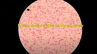 Salmonella in Gram stain [upl. by Nairred]