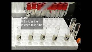 cold agglutination titer assay [upl. by Retsevel]