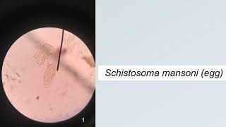 Trematodes Parasitology Practice Microscopic Identification [upl. by Barney]