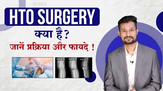 High Tibial Osteotomy Surgery HTO सर्जरी क्यों और किसे करानी चाहिए amp फायदे  Dr Nikhil Charde [upl. by Clemence]