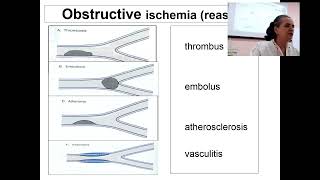 About Abnomality of periferal blood flow in 3 min Professor Maksimovich N Ye [upl. by Teodorico]