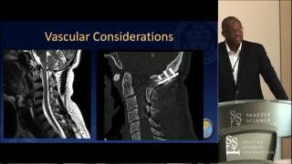 Occipitocervical Junction Stabilization  D Kojo Hamilton MD [upl. by Hendrick]