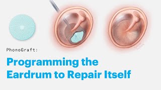 PhonoGraft Programming the eardrum to repair itself [upl. by Moynahan]