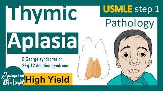 Thymic Aplasia  DiGeorge syndrome  22q112 deletion syndrome  USMLE step 1 [upl. by Murray429]