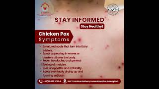 Chicken Pox Symptoms [upl. by Arateehc]