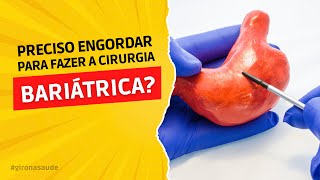 Como é feita a cirurgia bariátrica [upl. by Garrot]