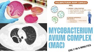 mycobacterium microbiology lecture  Mycobacterium avium complex MAC Easy Microbiology [upl. by Erl898]