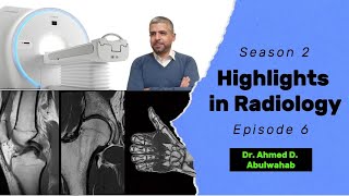 Highlights in Radiology S2 E6 anterior cruciate ligament tear [upl. by Kinch]