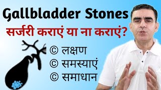 बिना ऑपरेशन के पित्ताशय की पथरी Gallbladder Stone का इलाज  Gallbladder Stones Symptoms [upl. by Alegnaed]