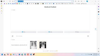 Demo Medical ChatBot using ViTGPT2 and T5 [upl. by Alguire]