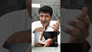 How to treat swelling after injury  Dr Jeya Venkatesh [upl. by Eoin]