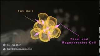 Stem cells therapy for breast cancer treatment [upl. by Ronen330]