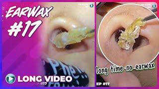 EP 17 Earwax ASMR Always pay attention to keeping your ears clean to have good ears [upl. by Senn]