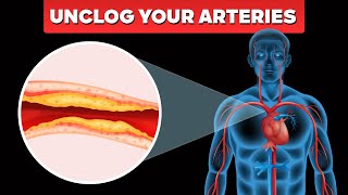 Clogged Arteries Shocking Symptoms amp Natural Solutions FAST [upl. by Attenor]