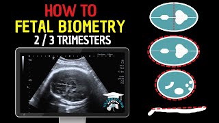 How to Perform Fetal Biometry in the Second and Third Trimesters  Practical Guide [upl. by Sevik600]