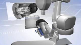 CyberKnife Robotic Radiosurgery  Variable Iris Overview [upl. by Yeclek]