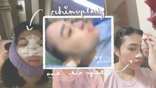 MY RHINOPLASTY JOURNEY Day 120 [upl. by Barth]