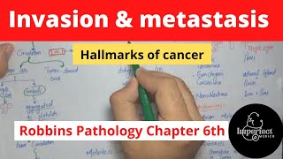 Invasion and Metastasis Hallmarks of CancerRobbins pathology chapter 6Neoplasiarobbinspathology [upl. by Euqram]