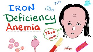 Iron Deficiency Anemia  All you need to know  Causes Symptoms Diagnosis Treatment [upl. by Mira]