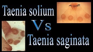 Difference between Taenia solium and Taenia saginata  Tsolium Vs Tsaginata [upl. by Wainwright]