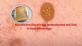 Roundworm or Ascaris Egg in stool Microscopy [upl. by Sigfried]