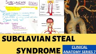 SUBCLAVIAN STEAL SYNDROME  Clincal anatomy series 7  Suyash shukla [upl. by Eicnahc]