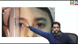 Ptosis IN TOTO Ophthalmology by Dr Sourabh Sharma [upl. by Cirderf]