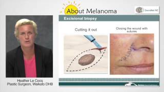 How is melanoma removed [upl. by Anelah]