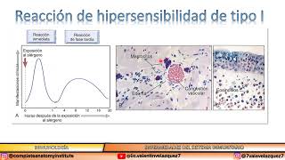 Reacción de hipersensibilidad tipo I Inmediata  IgE [upl. by Ladnyc779]