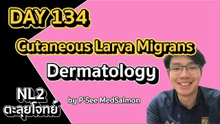 ตะลุยโจทย์ NL2 คละโจทย์ DAY 134 “Cutaneous Larva Migrans” MedSalmon ติว NL by พี่ซี [upl. by Mctyre]