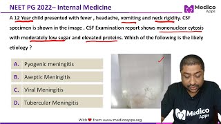 NEET PG Recall 2022 Question  Internal Medicine  Tubercular Meningitis [upl. by Saidee]