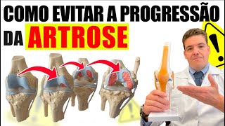 Aula 3 Como evitar a progressão da Artrose [upl. by Fancy709]