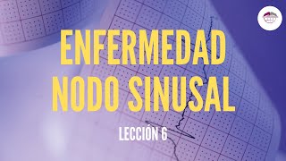 6 ENFERMEDAD NODO SINUSAL ELECTROCARDIOGRAFÍA [upl. by Eenitsed]