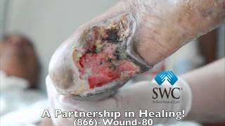 Heel Vascular Wound Healing Morph [upl. by Ahsenrat]