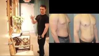 Adolescent Gynecomastia with Dr Blau  JOSES STORY [upl. by Nnanerak83]