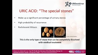 Urowebinar Medical Management of Urolithiasis [upl. by Ephrayim153]