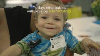 What if a word could save 9 babies a day Kernicterus [upl. by Alaham]