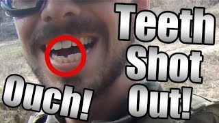 Airsoft Funny Moments and Fails Ep 9  Teeth Shot Out AGAIN Tactical Cows and More [upl. by Lorine968]