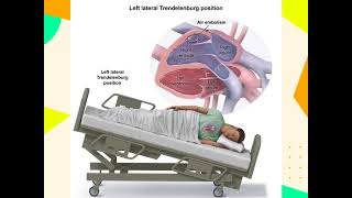 NCLEXRN Review 25 Questions [upl. by Obala259]