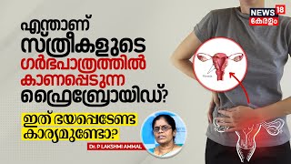 Dr Q  എന്താണ്‌ സ്ത്രീകളിൽ കാണപ്പെടുന്ന Uterine Fibroids ഇത് ഭയപ്പെടേണ്ട കാര്യമുണ്ടോ  N18V [upl. by Eiramadnil239]