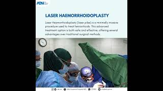 Laser Haemorrhoidoplasty Surgery LHP [upl. by Geis]