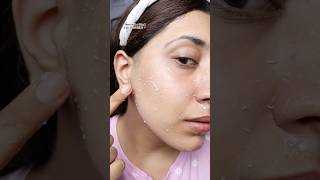 This gel peels all the dead skin off😱😍 korean skincare makeup zudio makeuptutorial girl [upl. by Dennis]