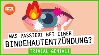 Was passiert bei einer Bindehautentzündung  trivialgenial  DAKGesundheit [upl. by Nodnnarb]