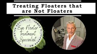 Treating Floaters Not Usually Considered Floaters [upl. by Vel]