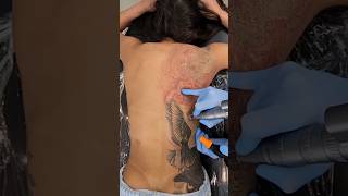 Tattoo Removal😱 [upl. by Stranger]