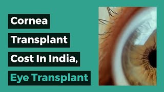 Cornea Transplant in India Eye Transplant Cost in India [upl. by Ayekin745]