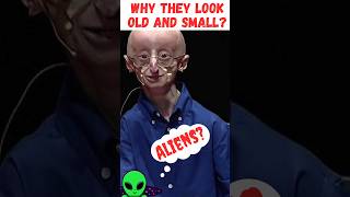 Why they Look Old In Their childhood  progeria Syndrome what are the causes syndrome alien [upl. by Mccreery419]