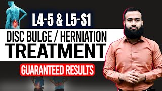 Get Rid Of L4 L5 And L5 S1 Disc Bulge With This Home Treatment  Guaranteed Results [upl. by Cohligan135]