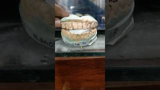 Dental model no 3viralshort viralvideo trendingshorts [upl. by Sucramat]